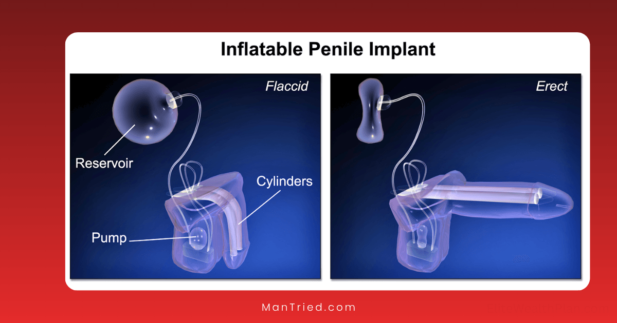 penile implant innovations
